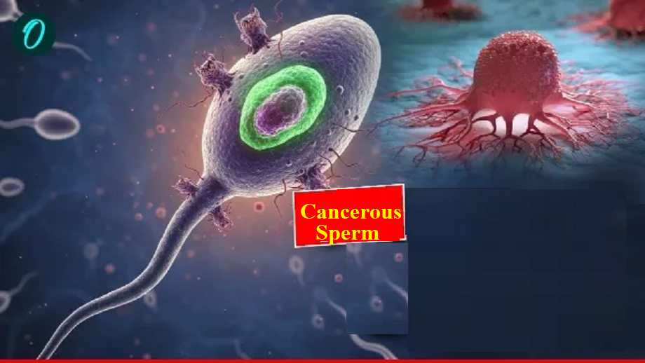 Britain: Sperm carrying cancer genes spreads death! 197 children born ...