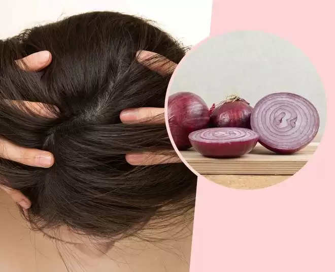 Haircare Tips:-The smell of onion is coming from the hair, so remove it  like this, try these remedies | NewsCrab