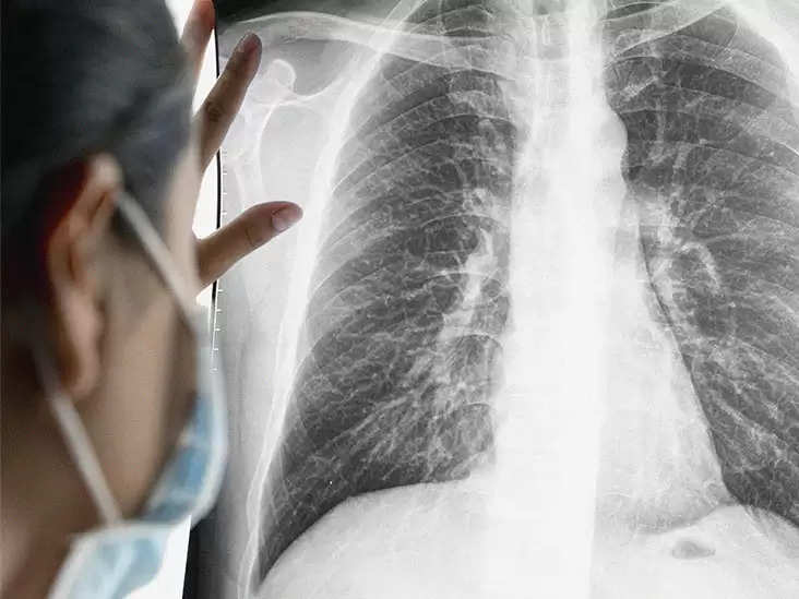 HEALTH TIPS: Why does lung cancer occur in non-smokers, here's what experts say