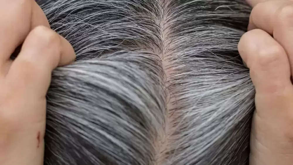 White Hair Remedy: These 3 things kept in the kitchen will make white hair  black again naturally, hair will turn black in a few days