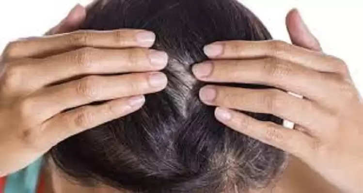 White Hair Treatment: White hair will get nourishment from the root! Hairs  will turn into black