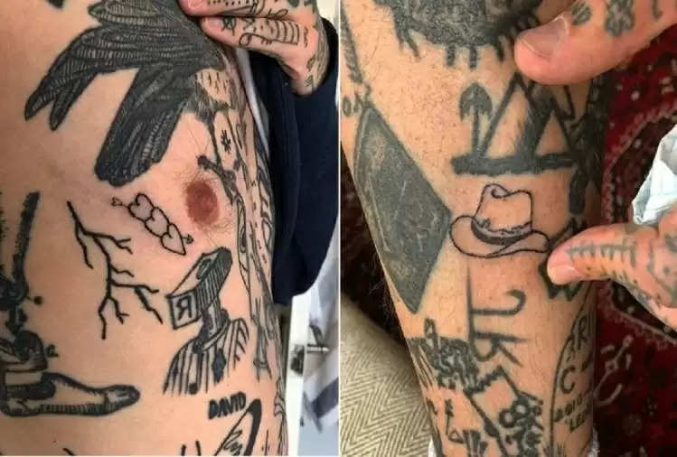 Take special care of these things after getting a tattoo