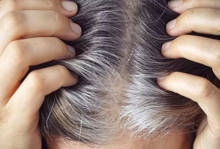 Hair Care Tips: Premature graying of hair? So try these home remedies to  prevent hair from turning white!