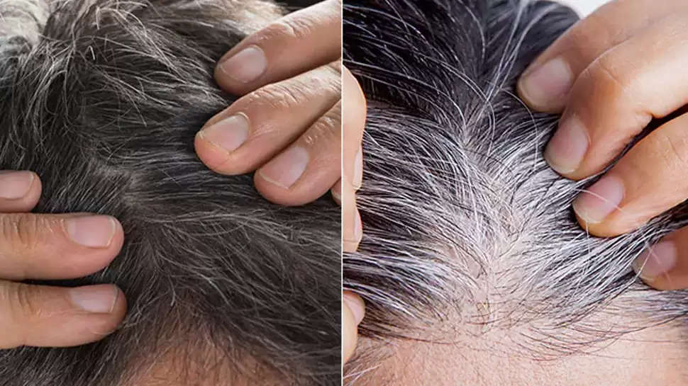 White Hair: Can Black Hair Turn White Again? Causes and ways to prevent it