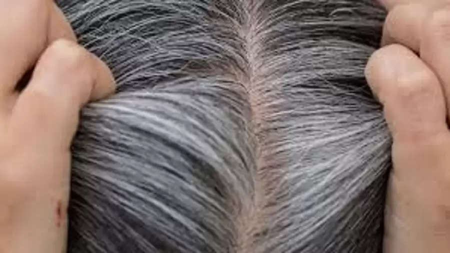 White Hair Treatment: White hair will get nourishment from the root! Hairs  will turn into black