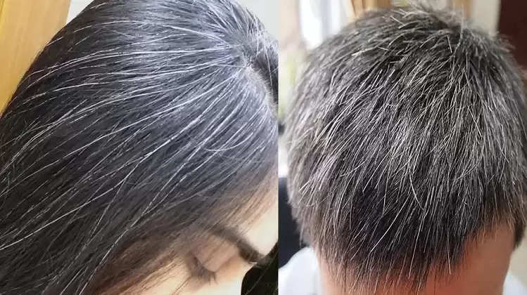 White Hair Problem: Follow these grandmother tips to turn your white hair  to black!