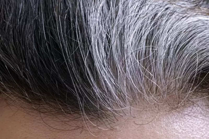 Curd Benefits for Hair: Embarrassment due to gray hair? Start applying curd  paste on your head, it will turn black as before...