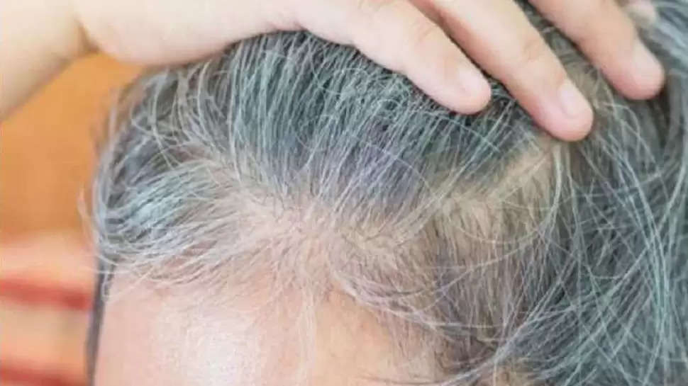 Hair Fall Solution: Worried about hair fall and graying? Adopt this easy  home remedy, you will get rid of all problems