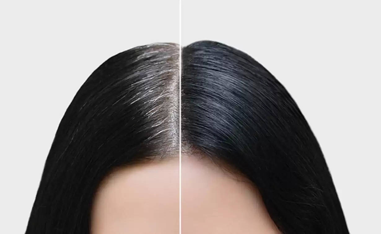 White Hair Problem: Use these things to turn white hair black naturally!