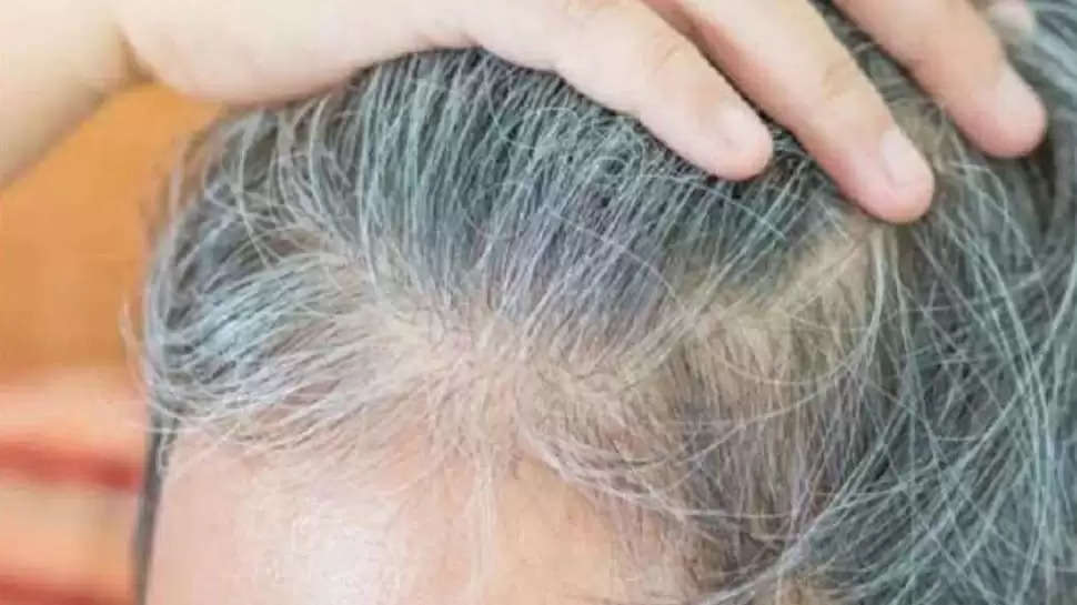 Curd Benefits for Hair: Embarrassment due to gray hair? Start applying curd  paste on your head, it will turn black as before...