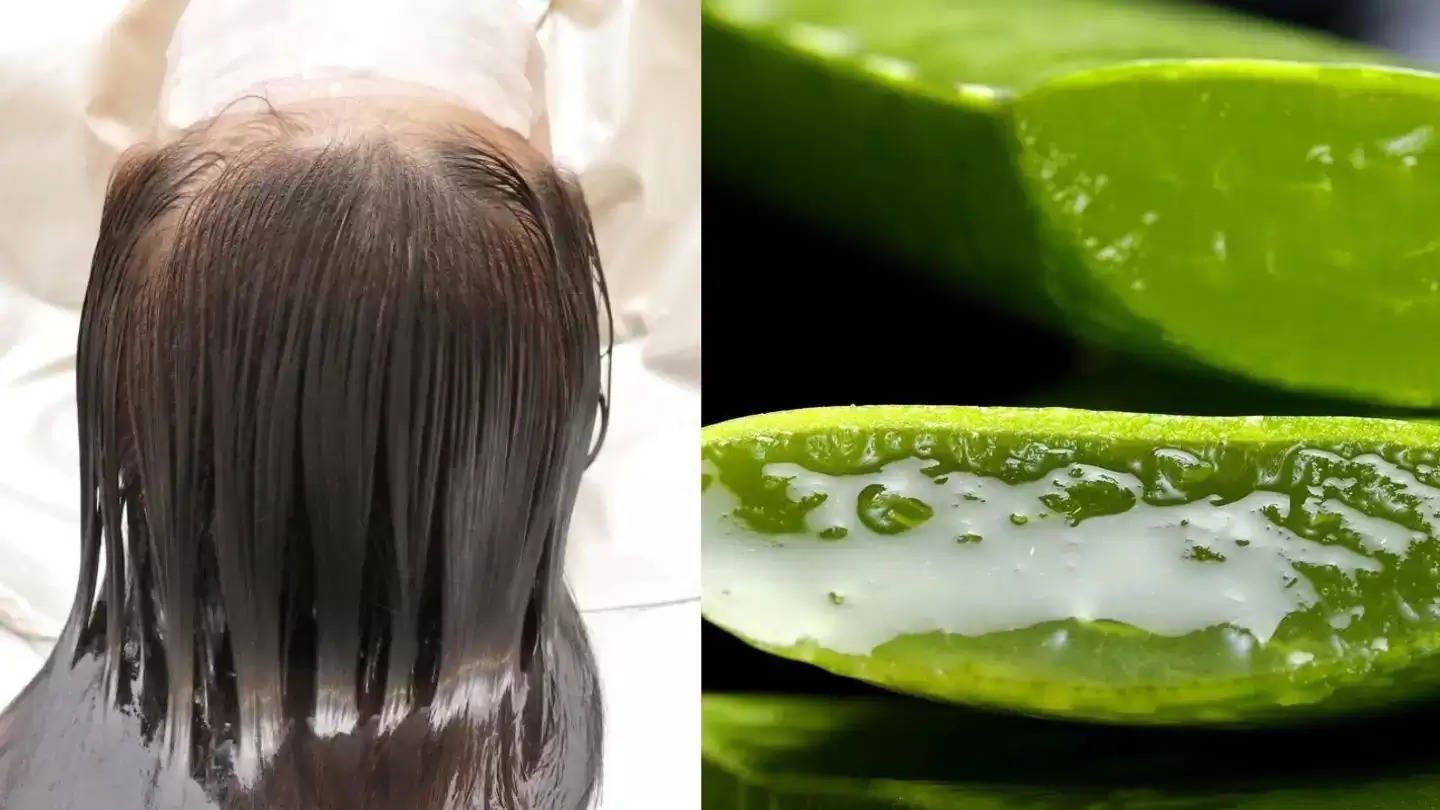 Hair Care: Try This Aloe Vera Hair Mask And Say Goodbye To Dandruff