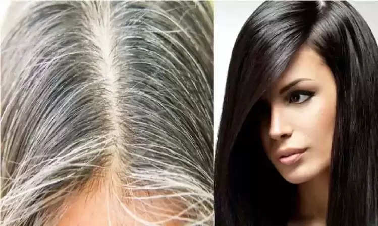 White Hair Problem: Use these things to turn white hair black naturally!