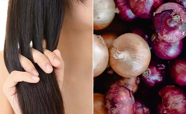 Health Tips: From hair loss to wrinkles, onion syrup can prevent these  things! Click here to know the benefits of drinking