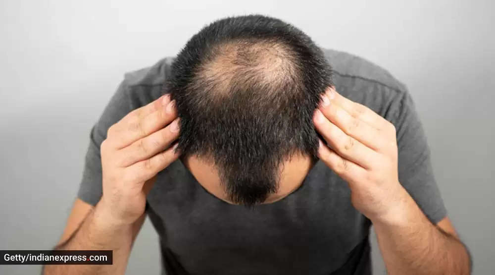 Hair Fall: Hair is falling for a long time, so you must also get this test  done..