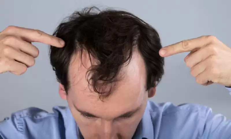 Hair Care Tips: Hairfall is happening due to sweating? Protect your hair  with these easy steps..