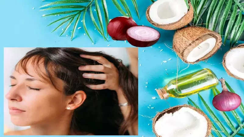 Hair Care Tips: To get rid of dandruff, apply onion juice and coconut oil  to the hair, know how...